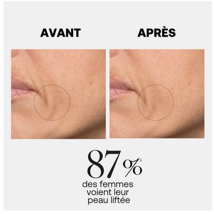 Serum za lice protiv bora Line Killer Firm Protiv bora i starenja