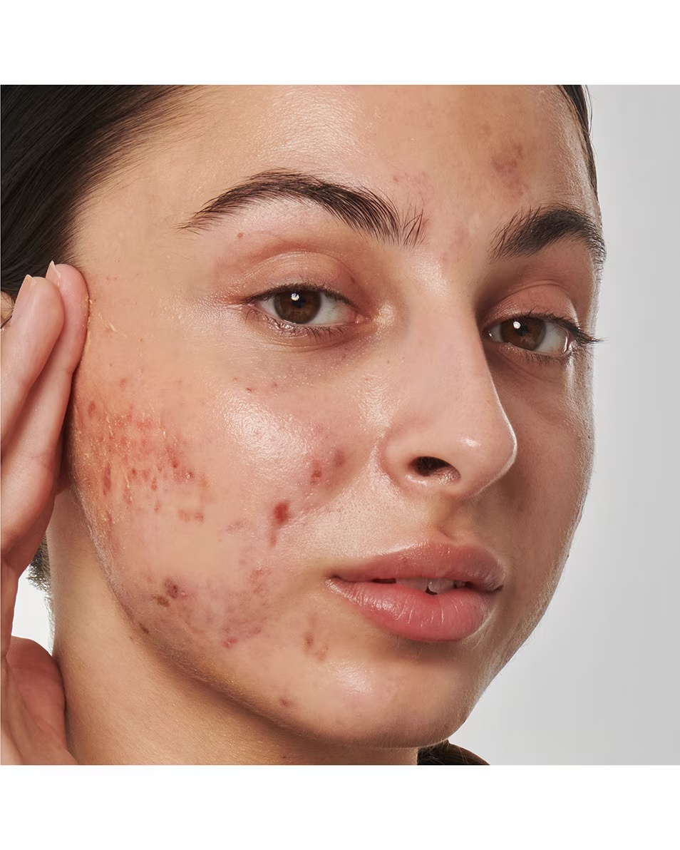 The Inkey List SUPERSOLUTIONS 1% RETINOL SERUM