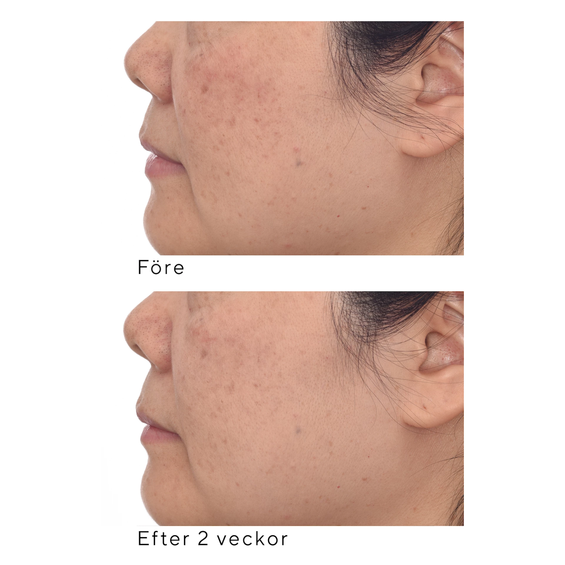 Serum za ispravljanje i zaštitu SPF30 30 ml - Murad