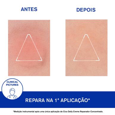 Uriage Cica Denní regenerační krémový koncentrát pro citlivou pleť 50 ml