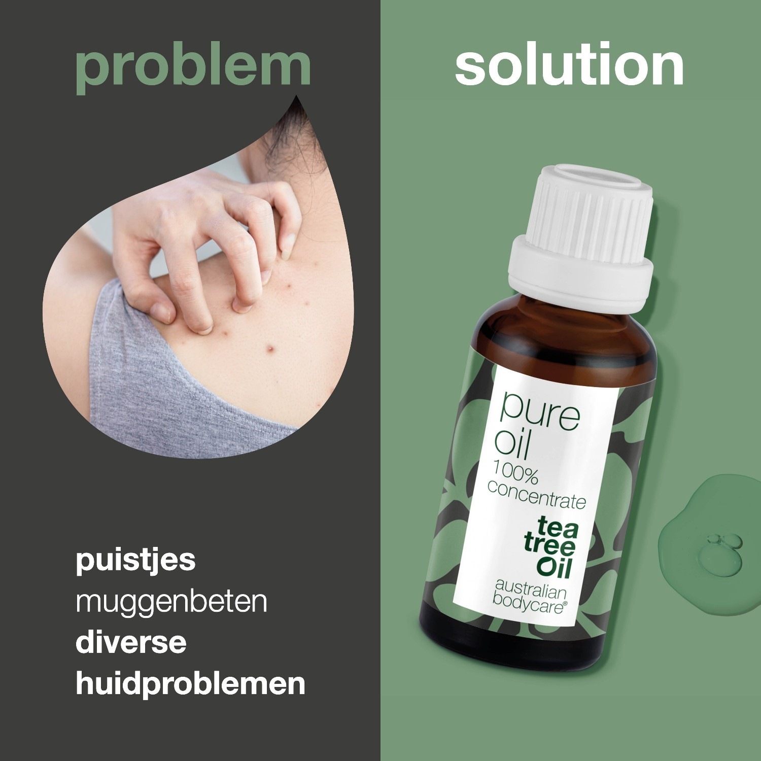 Australian Bodycare tīrā ķermeņa eļļa - 10 ml