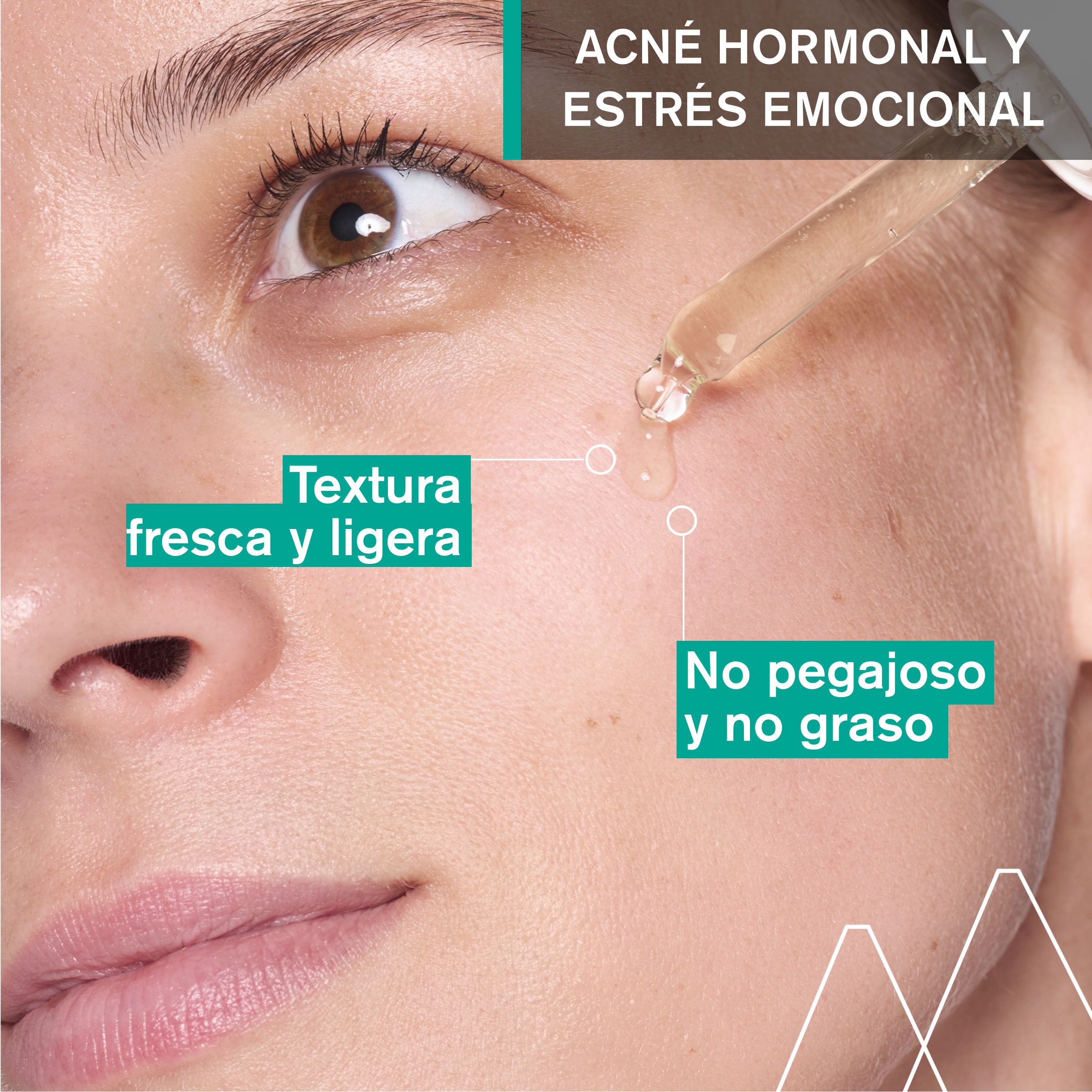 Hyseac pretpūtīšu serums pret pinnēm Pinnes ārstēšana