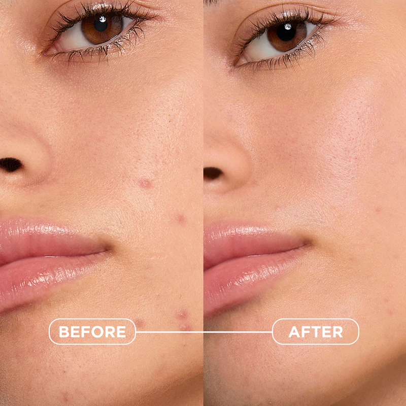 Bioderma Sébium Kerato+ gelový krém proti nedokonalostem pleti náchylné k akné
