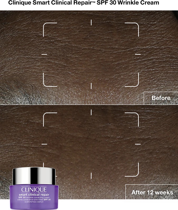 Clinique Smart Clinical™ Repair крема за корекцију бора SPF 30 крема за боре SPF 30