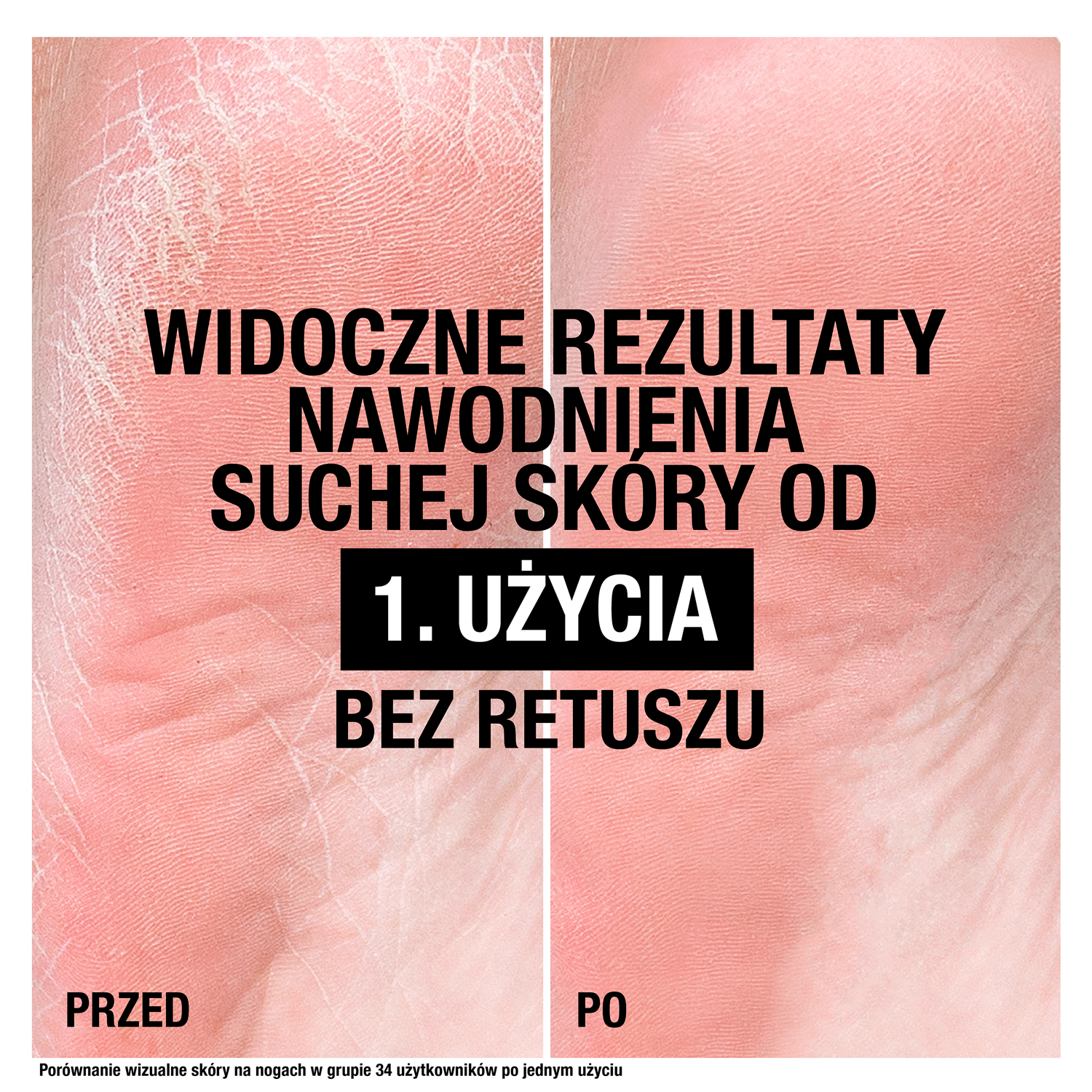 Neutrogena Intensiv Reparation