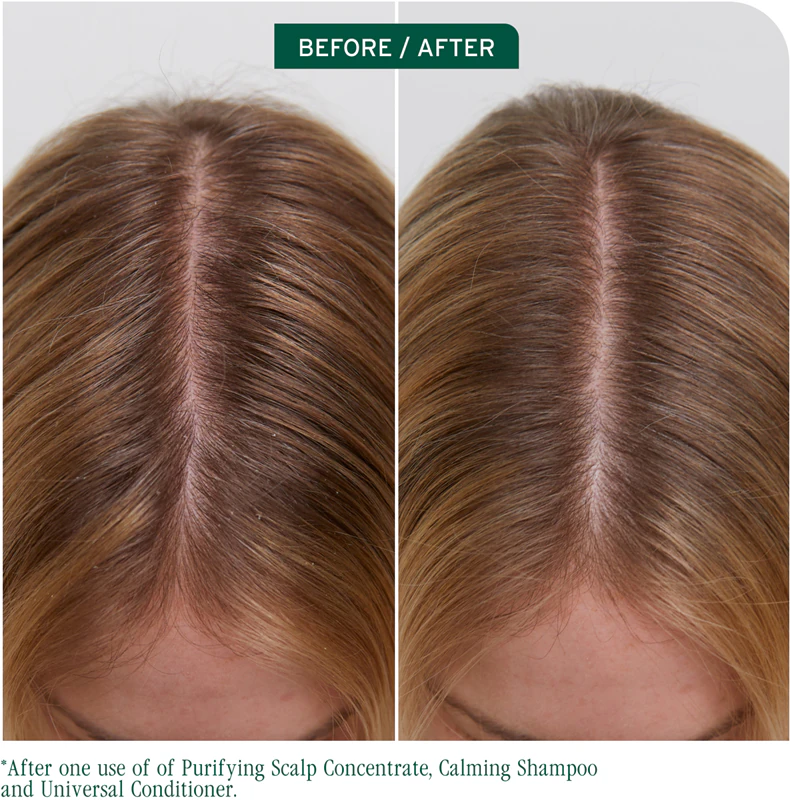 Biolage ScalpSync zklidňující šampon