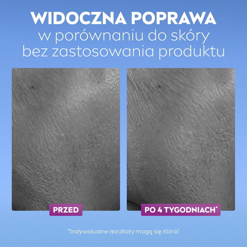 Nivea LUMINOUS630 ĀDAS MIRDZUMS