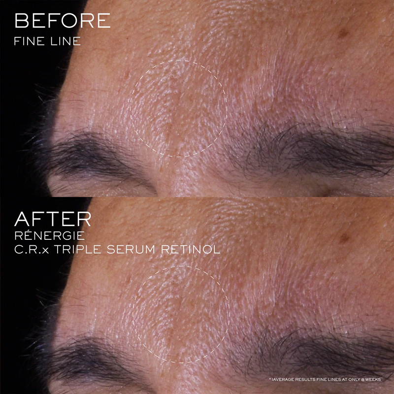 Lancôme Rénergie CRX Triple Serum Retinol gezichtsserum