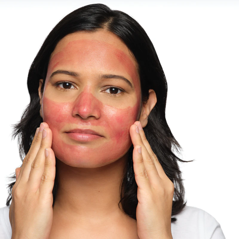 Solução Peeling AHA 30% + BHA 2% da The Ordinary