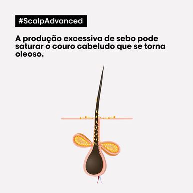 L'Oréal Professionnel Serie Expert Scalp Advanced Anti-Grass Shampoo for sensitiv og fet hodebunn 300 ml