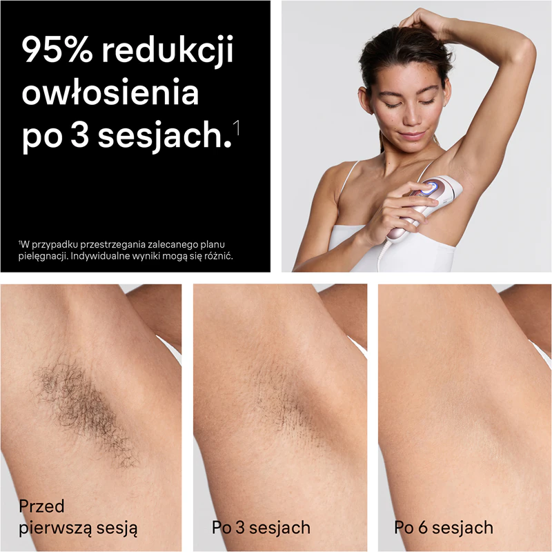 Braun Smart IPL Skin i·expert PL7432: aparelho inteligente de depilação a laser para corpo, rosto, virilha e axilas.