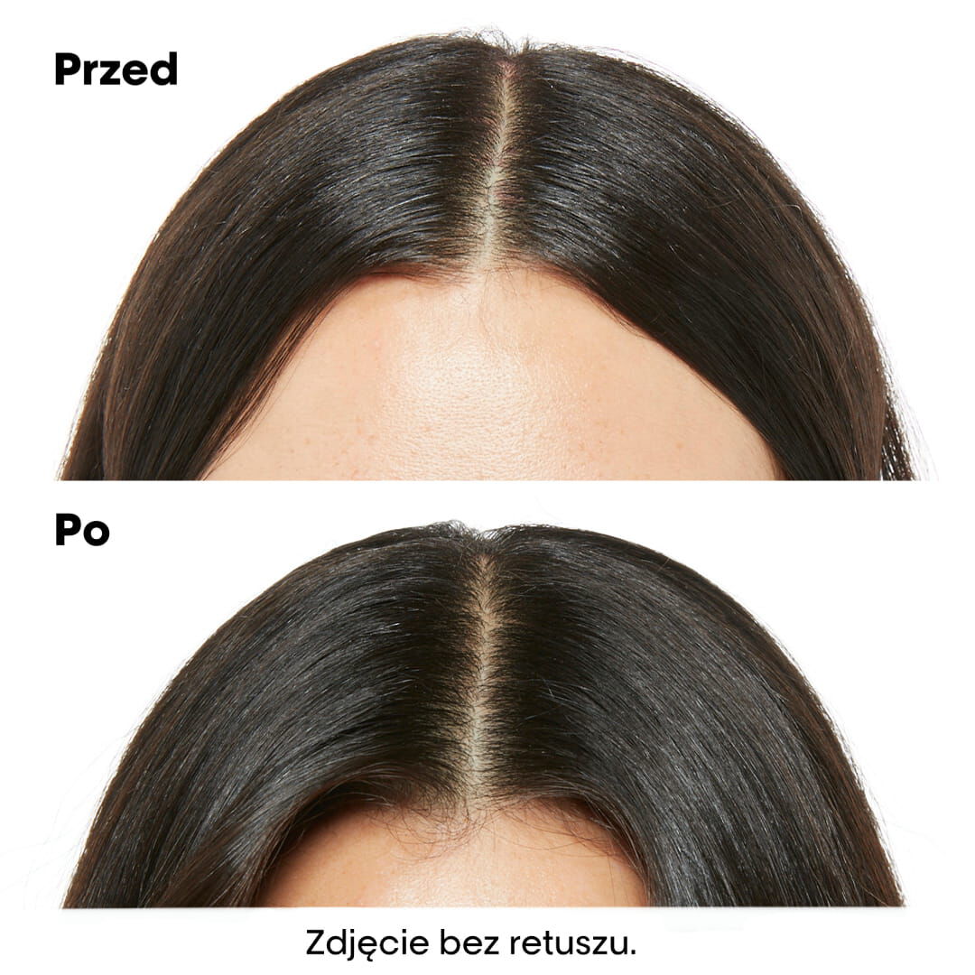 L'Oréal Professionnel Paris Scalp Advanced