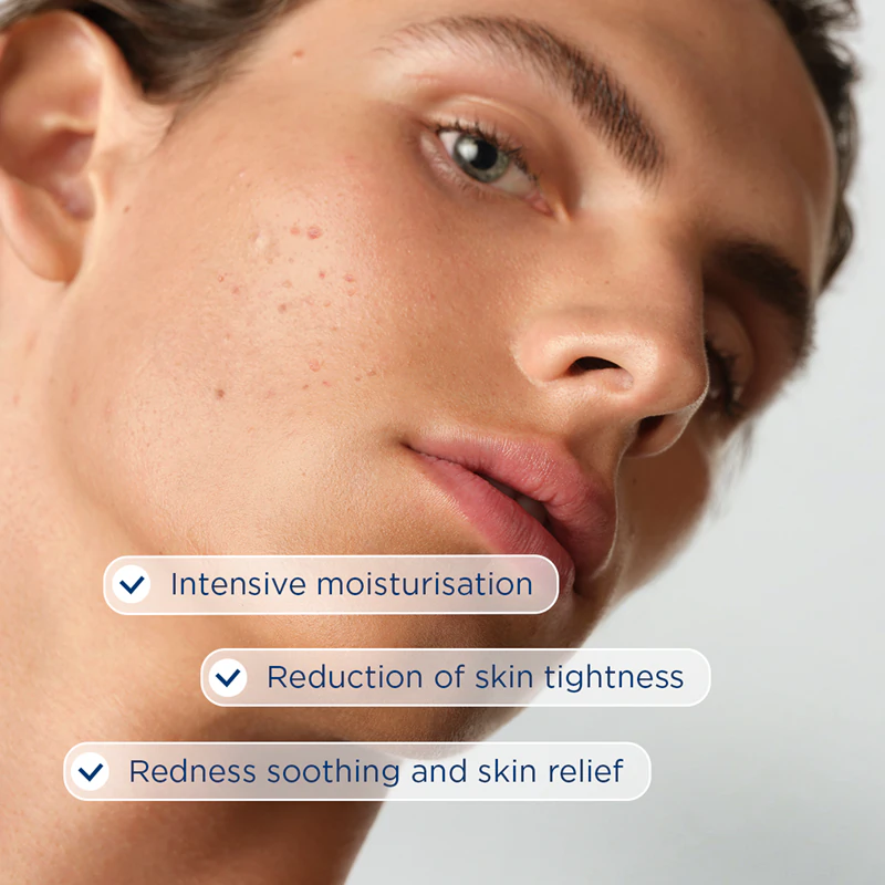 Creme hidratante Bioderma Sébium Hydra para pele seca e irritada devido ao tratamento da acne.