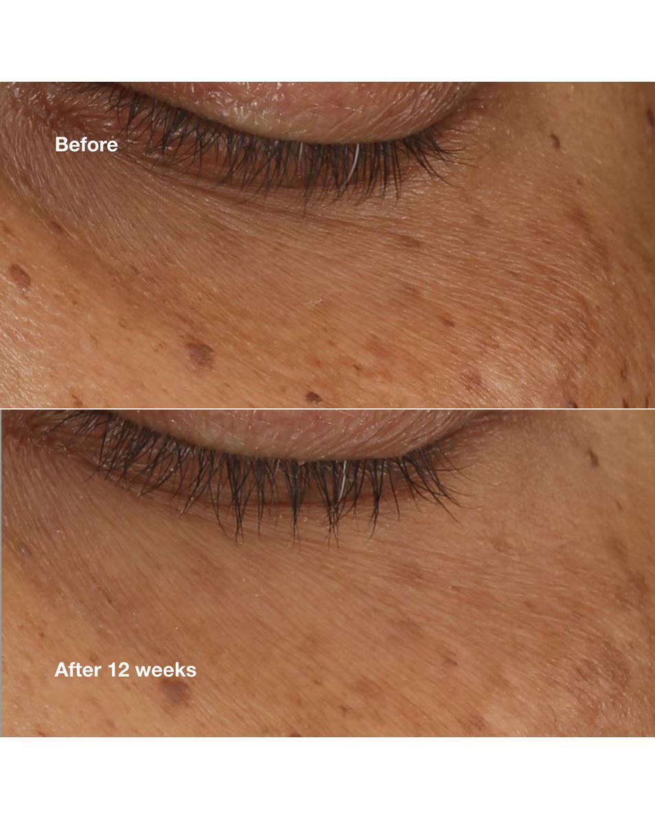 Ser concentrat iluminator CLINIQUE All About Eyes Combate cearcănele și pungile de sub ochi