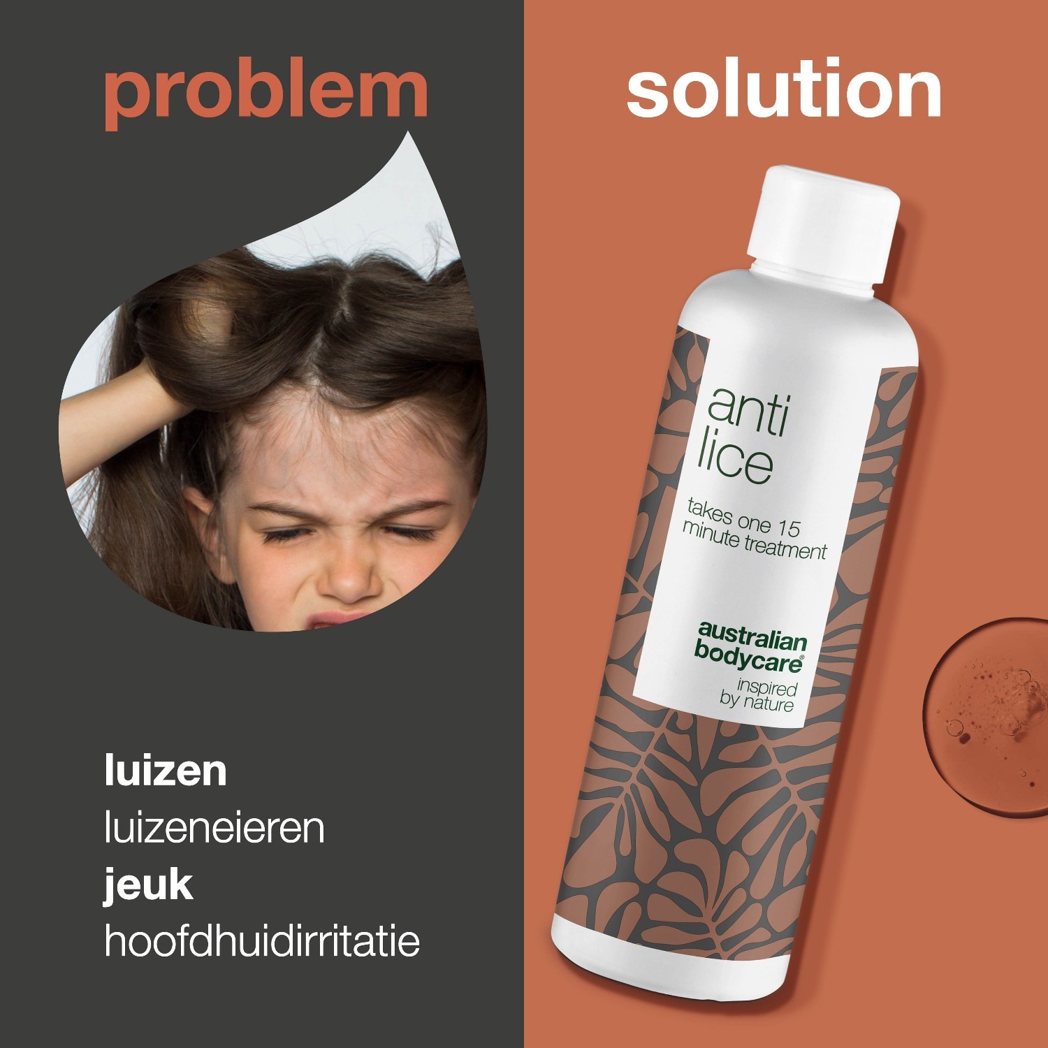 Australian Bodycare matu kopšanas komplekts pret utīm – 100 ml