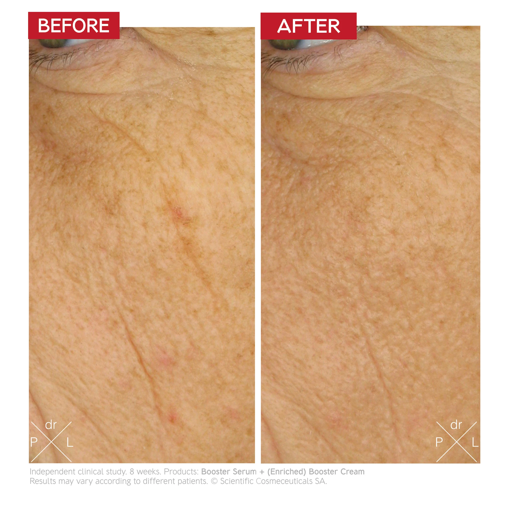 Dúsított Booster Krém 50 ml - Dr. LEVY Svájc