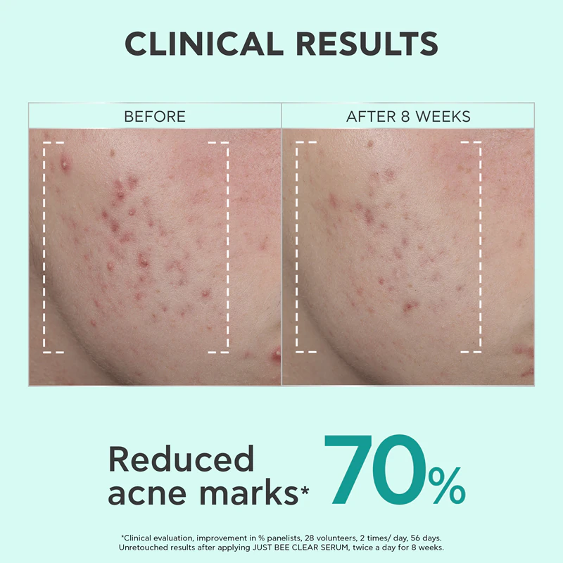 Apivita Just Bee Clear Serum – Serum für fettige und problematische Haut