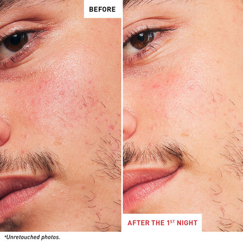 Huile-sérum de nuit multi-perfectionnante Skin Therapy