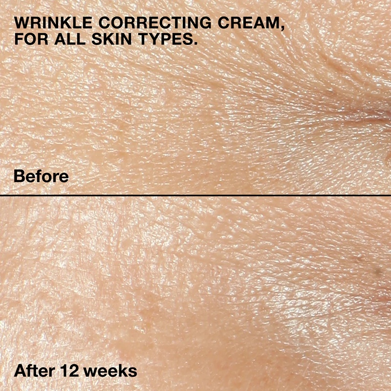 „Clinique Smart Clinical™ Repair Wrinkle Correcting Cream“ maitinamasis kremas nuo raukšlių