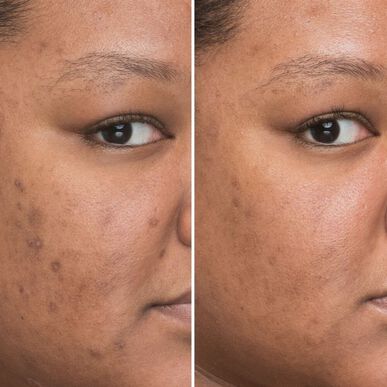 IT Cosmetics Bye Bye Dark Spots koncentruotas veido serumas, apsaugantis nuo tamsių dėmių su niacinamidu, 30 ml