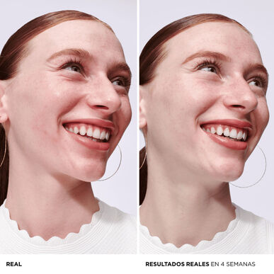IT Cosmetics Bye Bye veido serumas nuo paraudimo 30 ml 30 ml