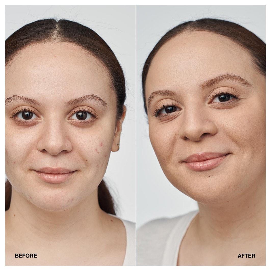 Clinique Foundation Even Better™ klinické sérum SPF – 30 ml