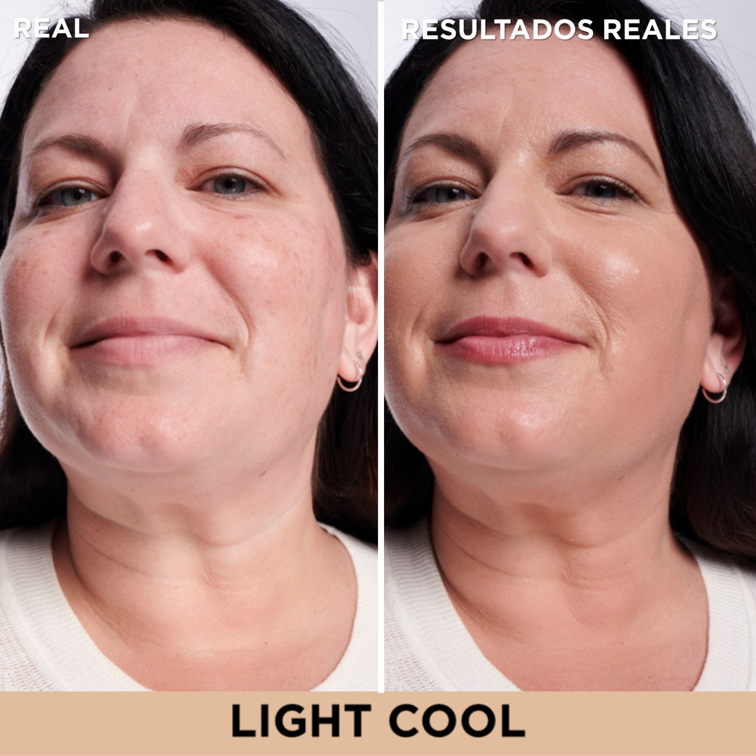 Serum za korekcijo temnih madežev Bye Bye Luksuzni korektorji