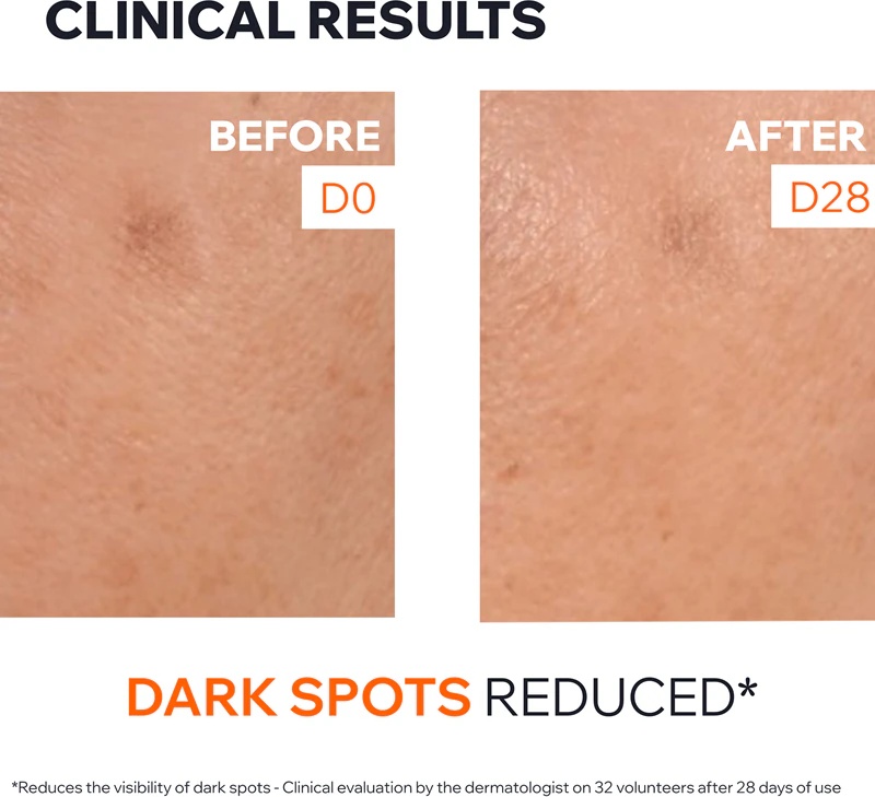 Uriage Dépiderm Anti-Dark Spot Brightening Booster Serum Серум за осветљавање дисколорације са ефектом осветљавања