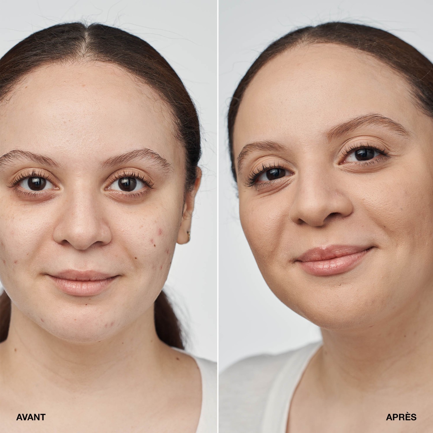 Clinique Clinical Serum