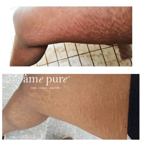 Základní tělový krém âme Pure
