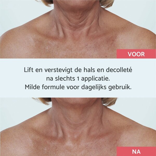 Remescar Neck & Décolleté krēms<br>40 ml, visiem ādas tipiem
