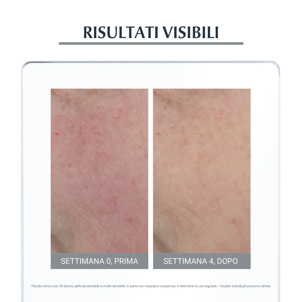 EUCERIN Eucerin pret apsārtumu nakts krēms 50 ml