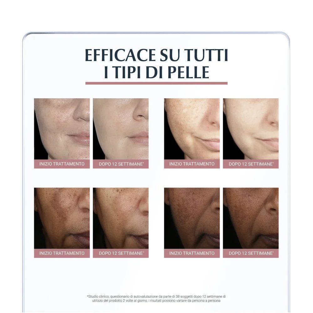 EUCERIN Eucerin Anti-Pigment Dual Serum 30 ml Anti-vlekken gezichtsserum