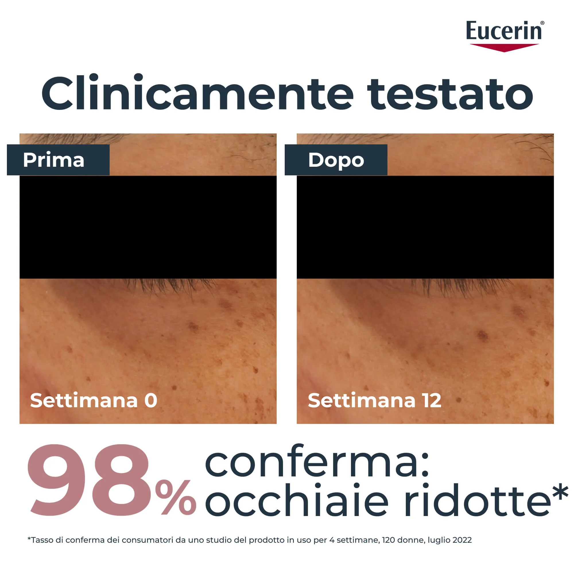 Anti-Pigment Anti-Pigment Contorno Occhi - Tratt.anti borse e occhiaie