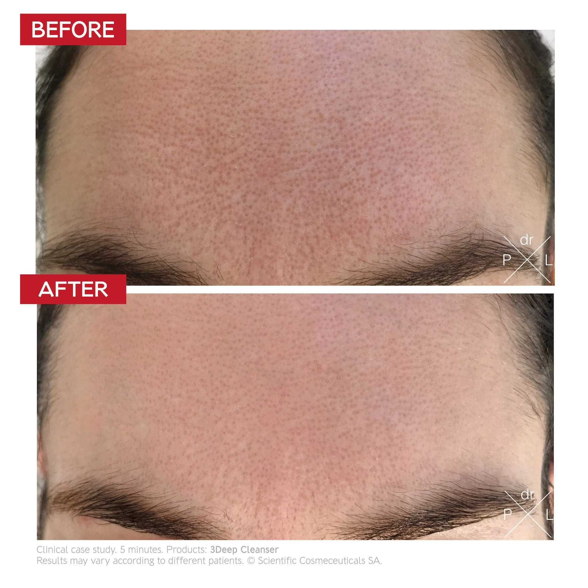3Deep Cell Renewal Micro-Resurfacing Cleanser 150 ml - Dr LEVY Švicarska