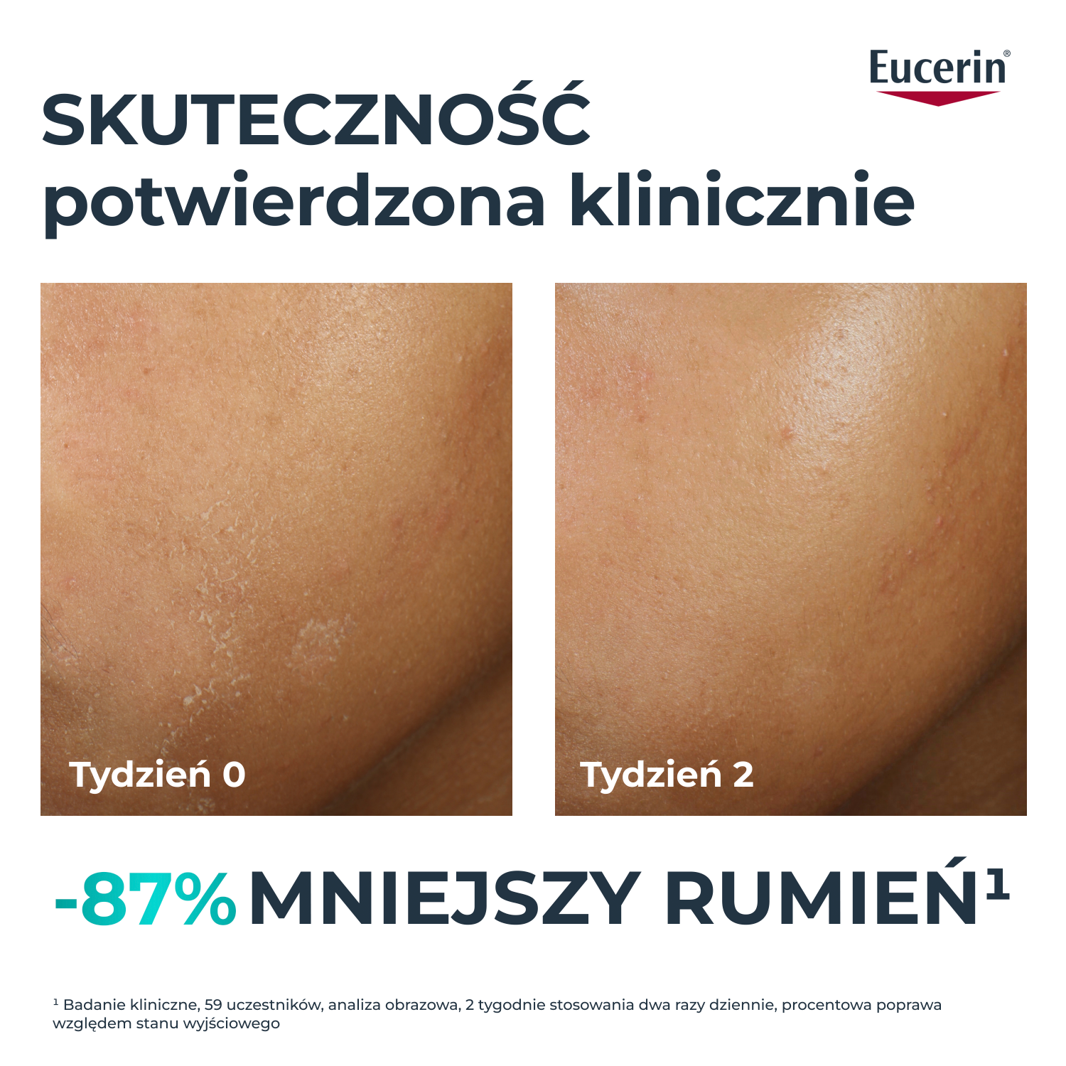 Eucerin DermoPure Clinical
