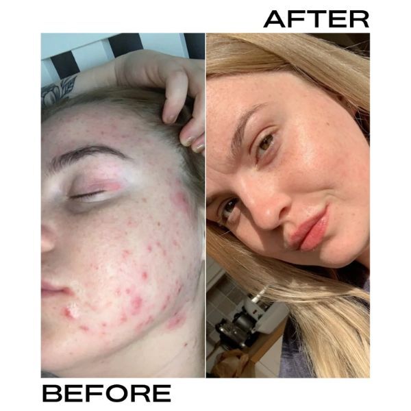 Conjunto de máscara facial e óleo iluminador de argila rosa britânica da PERL Cosmetics