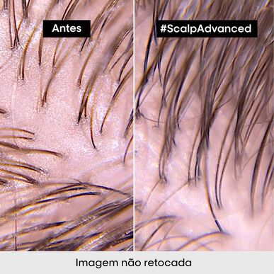 L'Oréal Professionnel Serie Expert Scalp Advanced Anti-Grass Shampoo for sensitiv og fet hodebunn 300 ml