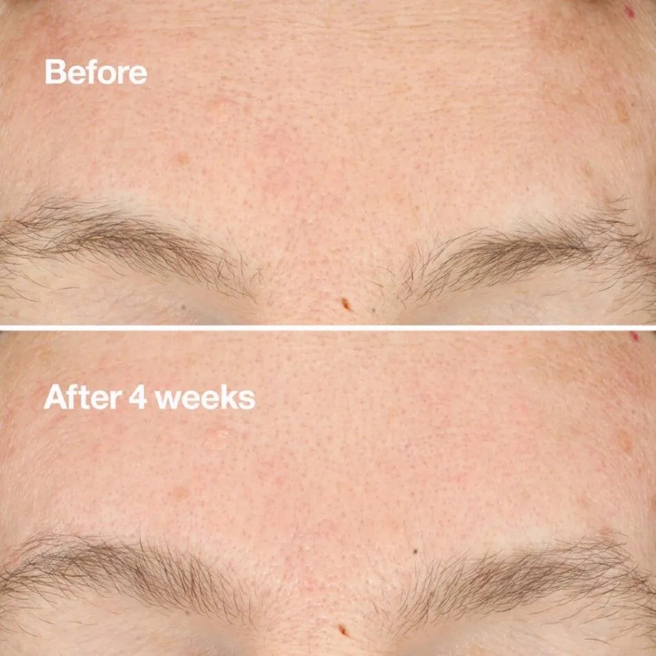 Clinique Clarifying Do-Over Peel Peeling do twarzy