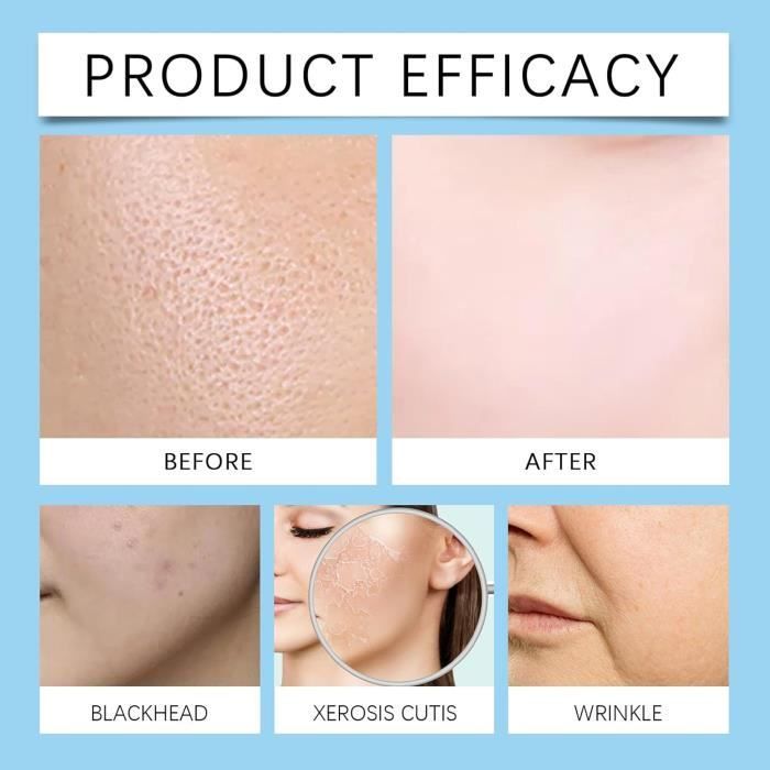 Lot de 3 systèmes de micro-infusion pour les lèvres,système de micro-infusion pour le visage avec sérum,pour tous les types de peau