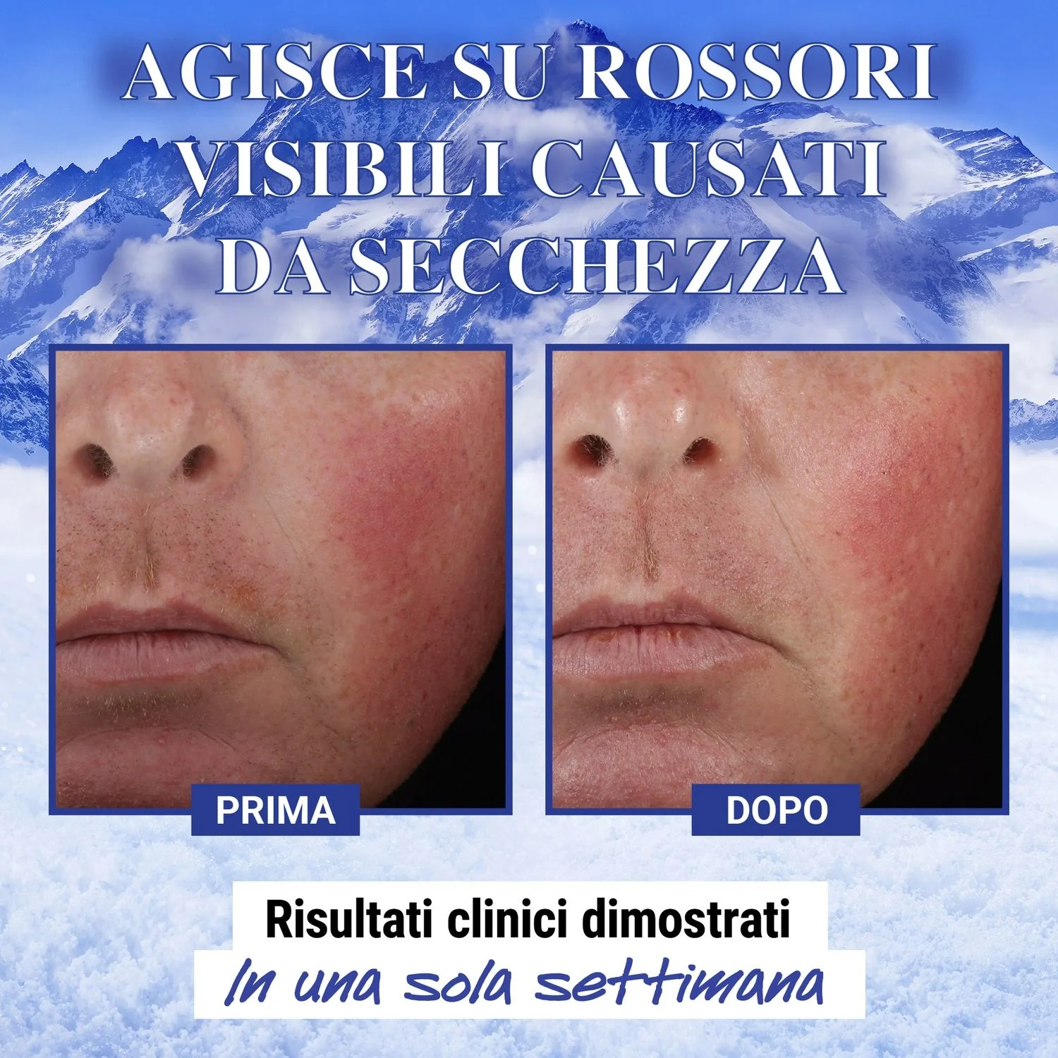 Idratanti Ultra Facial Advanced Repair Barrier Cream - Trattamento Riparatore, Tratt.viso 24 ore idratante, Tratt.viso 24 ore lenitiva