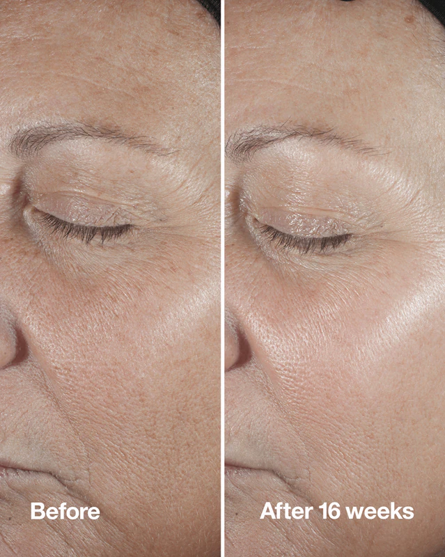 Sérum na korekciu vrások Clinique Smart Clinical™ Repair
