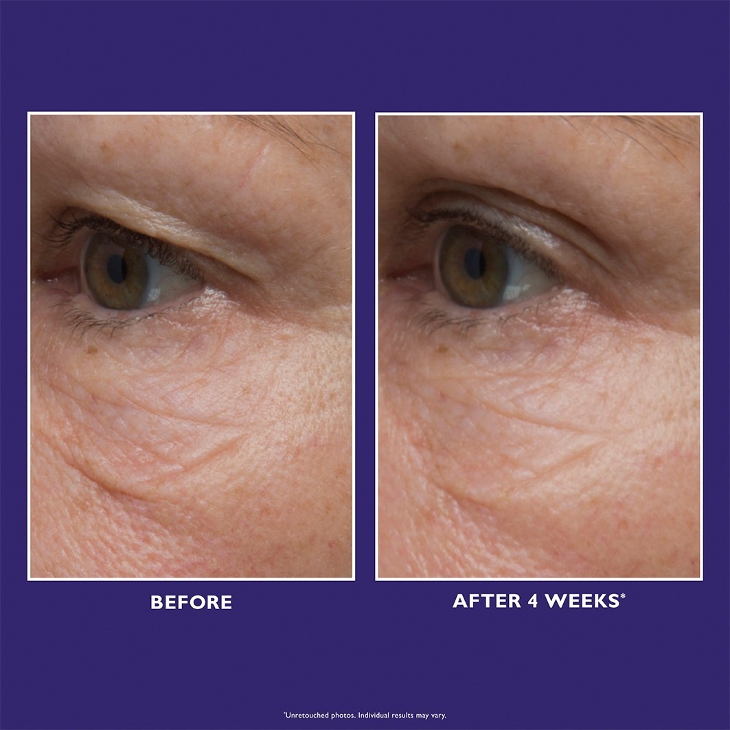 Krema za oči Peter Thomas Roth – 1 komad