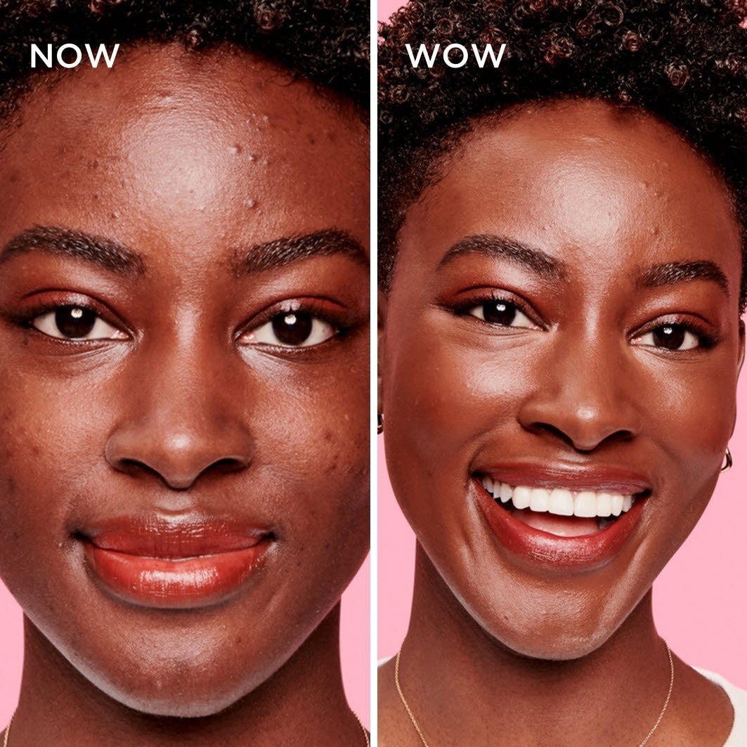 Benefit Concealer Boi-ing Cakeless - 5 ml