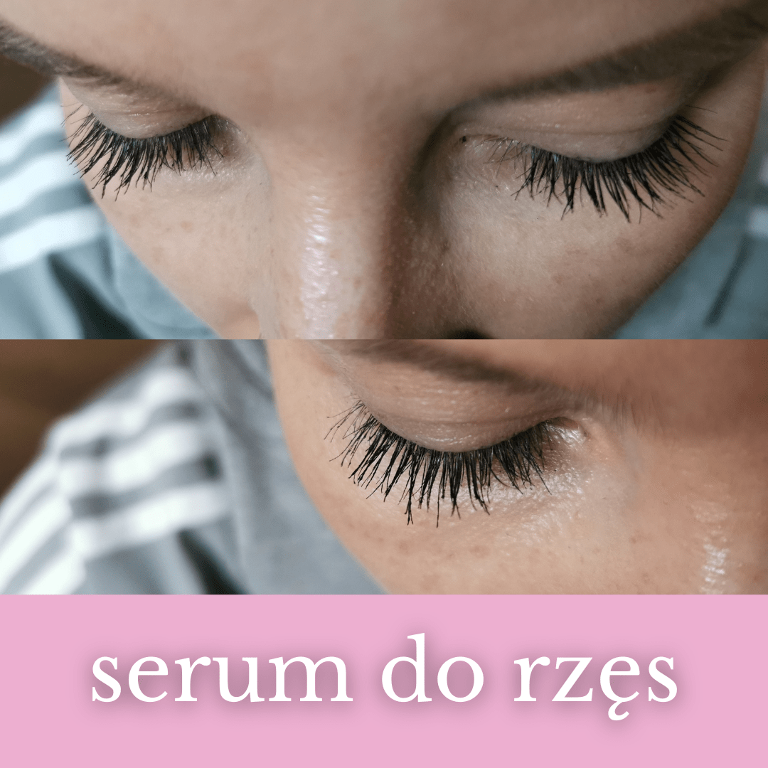 Nachemii serum za trepalnice