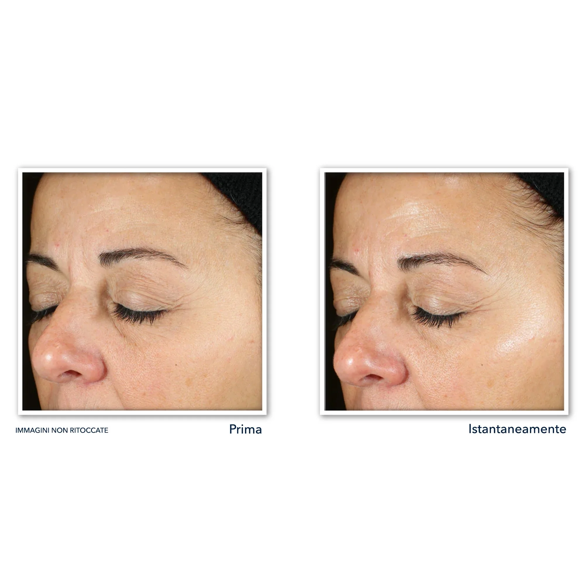 Multi Correxion Revive + Glow Siero Viso - Siero viso illuminante