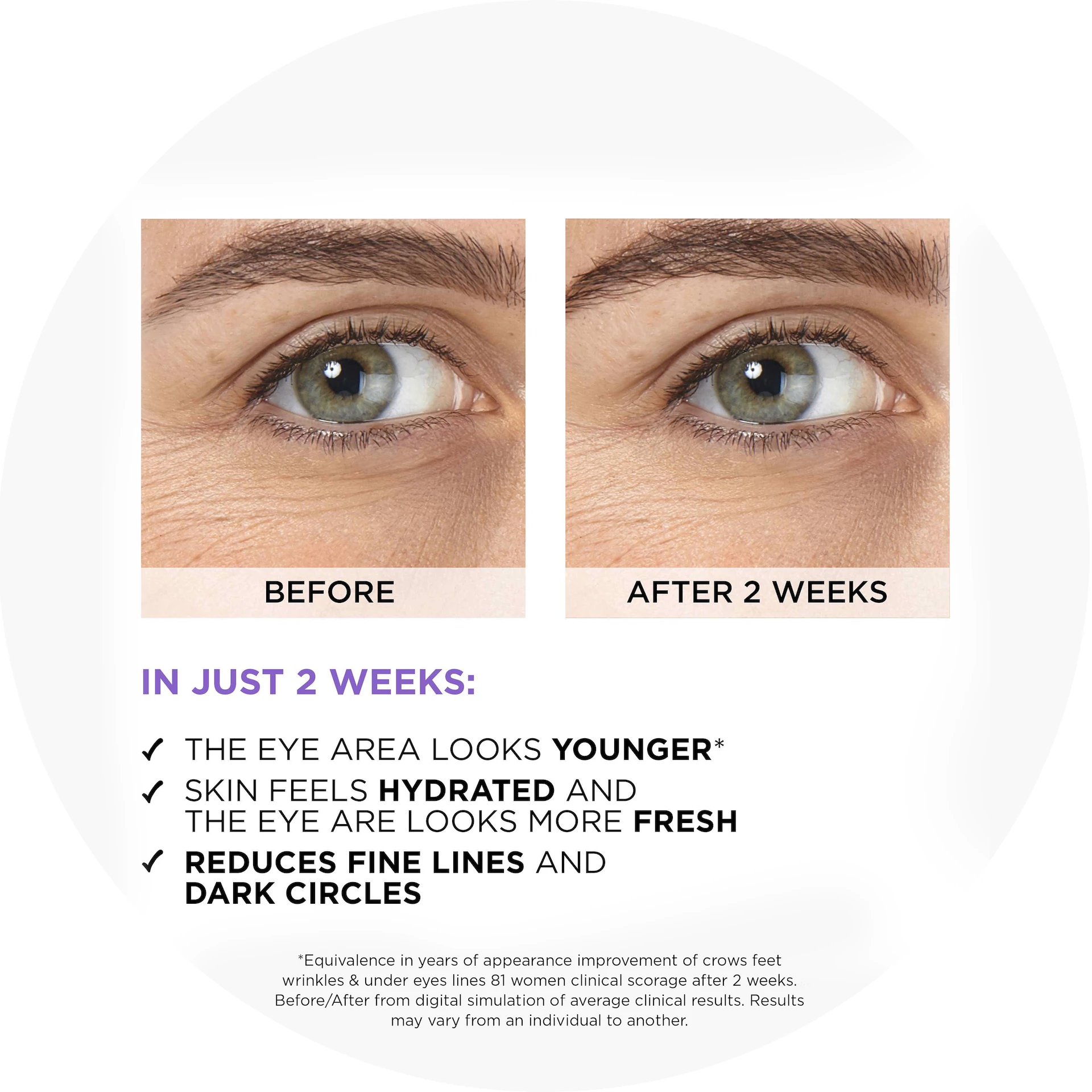 Revitalift Filler szemkörnyékápoló szérum 2,5% hialuronsav + koffein 20 ml - L'Oréal Paris