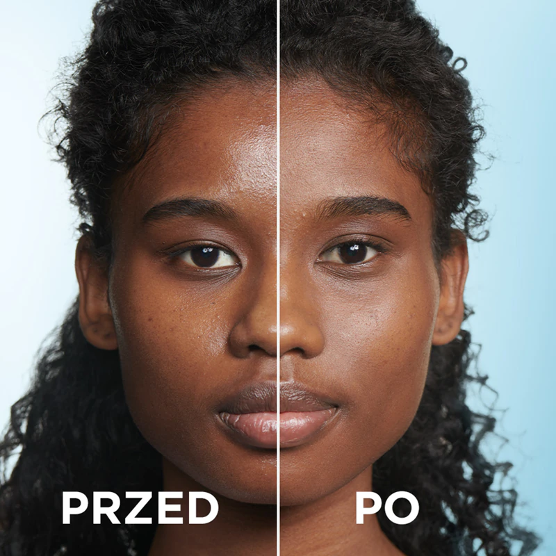 Gel de Limpeza Hidratante Anti-Imperfeições Garnier Pure Active