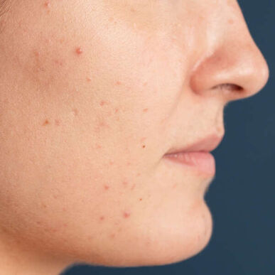 Sérum exfoliante enzimático, unificador e iluminador Blue Radiance de Freshly Cosmetics, 30 ml