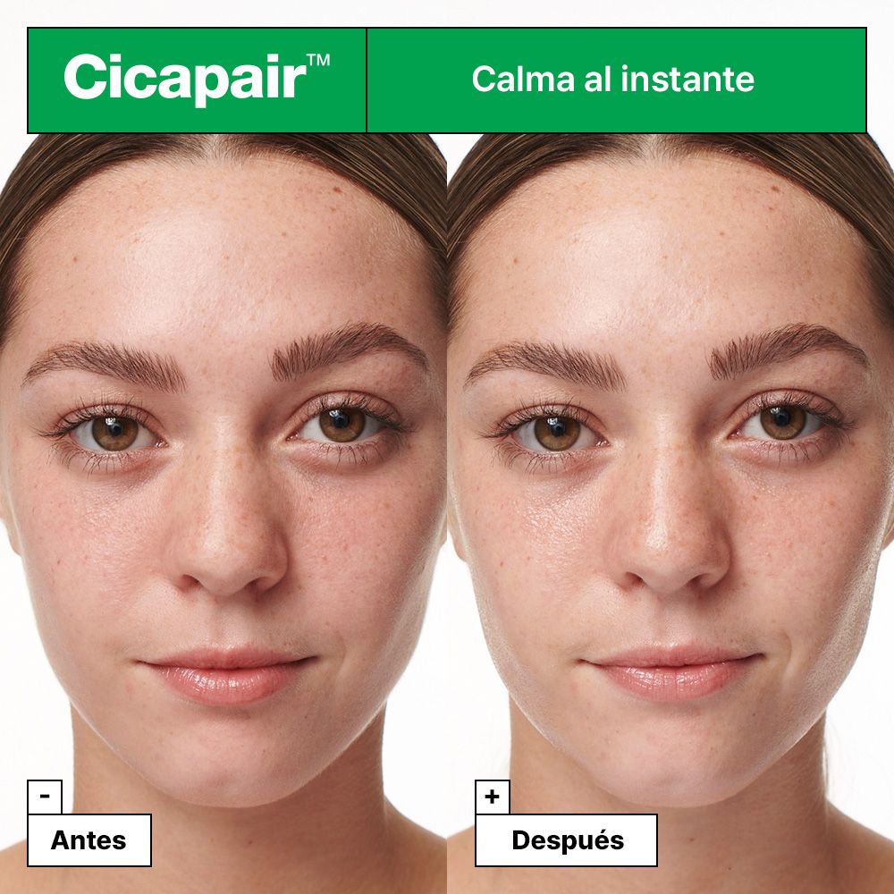 Cicapair Intense Soothing Repair Serum Pomirjujoča nega za občutljivo kožo